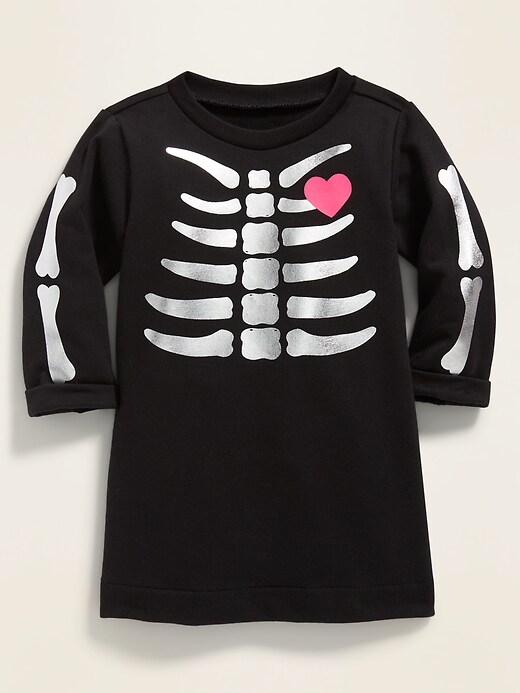 View large product image 1 of 2. Skeleton-Graphic French Terry Dress for Baby